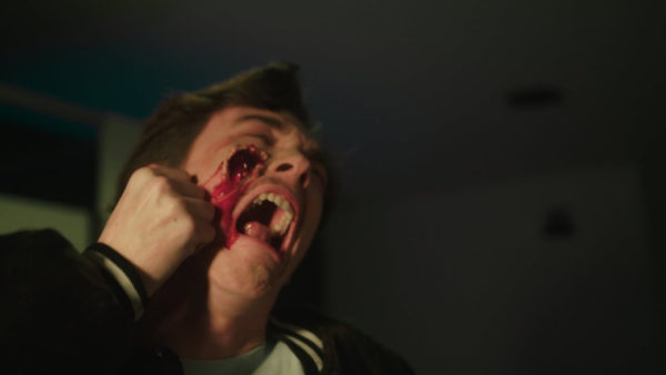 Pimple Patch_Still (3)